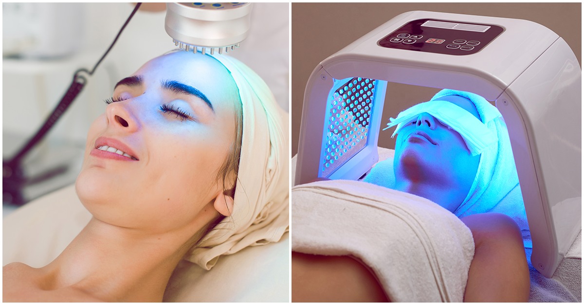 Luz azul para tratar el acné, ¿funciona?