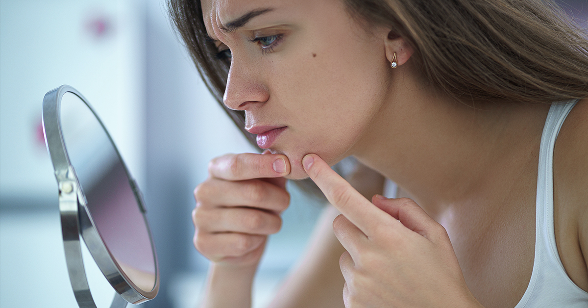 Pimprose oil para tratar el acné, sí o no