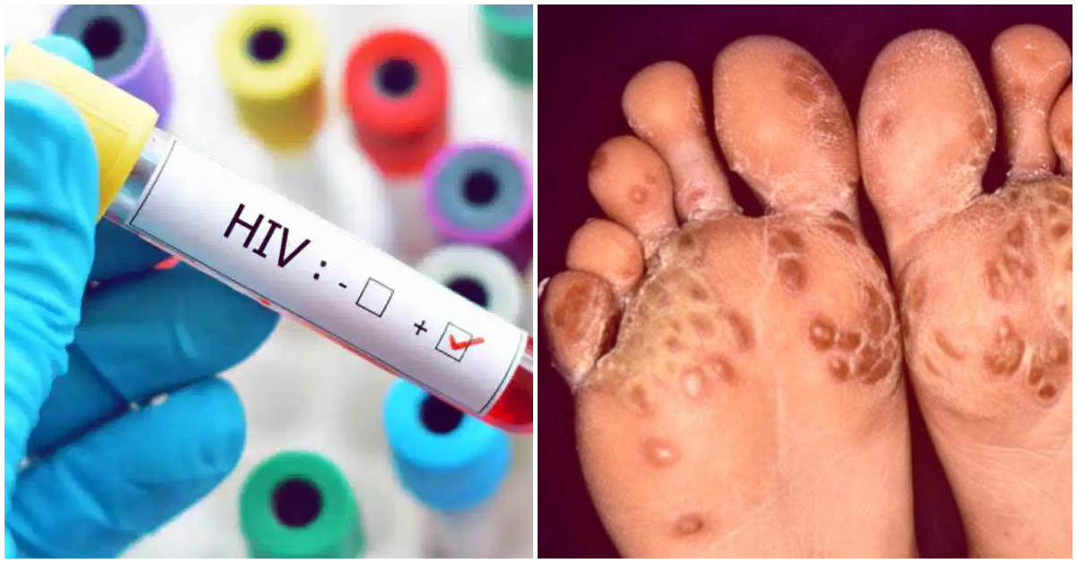 Enfermedades sexuales que afectan tu fertilidad