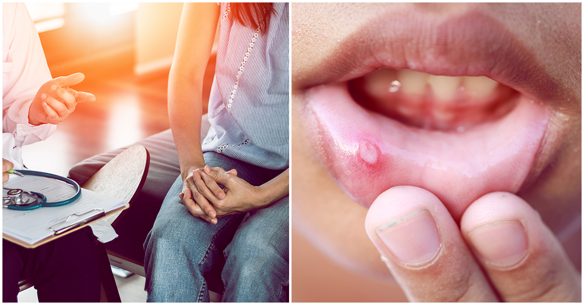 Ésta es la ETS que causa úlceras en la piel