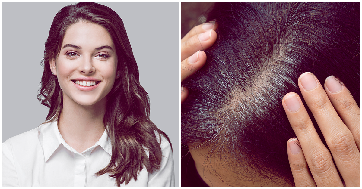 Razones por las que salen canas